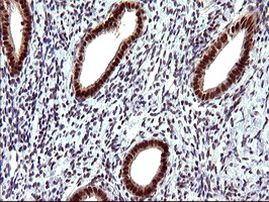 UPRT Antibody in Immunohistochemistry (Paraffin) (IHC (P))