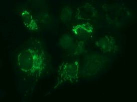 MUT Antibody in Immunocytochemistry (ICC/IF)