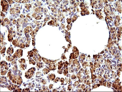 HERPUD1 Antibody in Immunohistochemistry (Paraffin) (IHC (P))