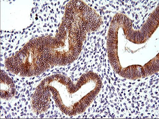 HERPUD1 Antibody in Immunohistochemistry (Paraffin) (IHC (P))