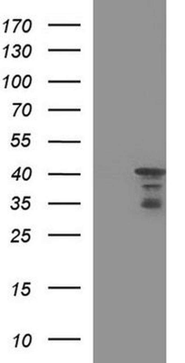 HERPUD1 Antibody in Western Blot (WB)