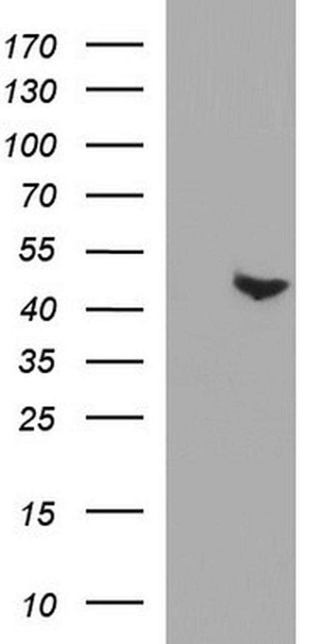 PAAF1 Antibody in Western Blot (WB)