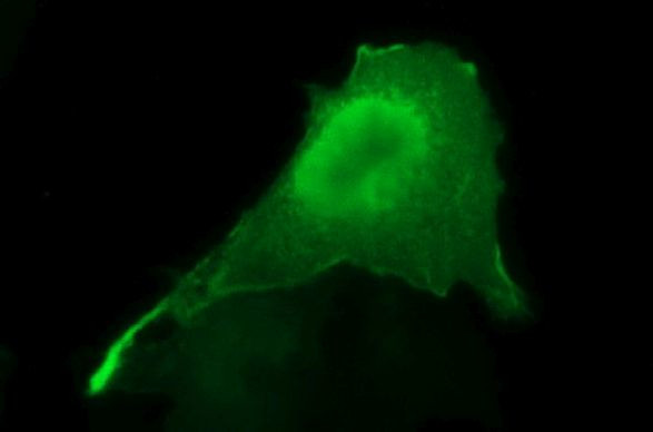 SPHK1 Antibody in Immunocytochemistry (ICC/IF)