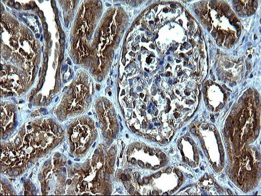 FNDC8 Antibody in Immunohistochemistry (Paraffin) (IHC (P))