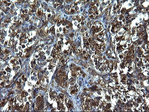 FNDC8 Antibody in Immunohistochemistry (Paraffin) (IHC (P))