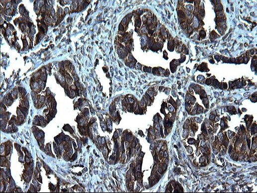 FNDC8 Antibody in Immunohistochemistry (Paraffin) (IHC (P))