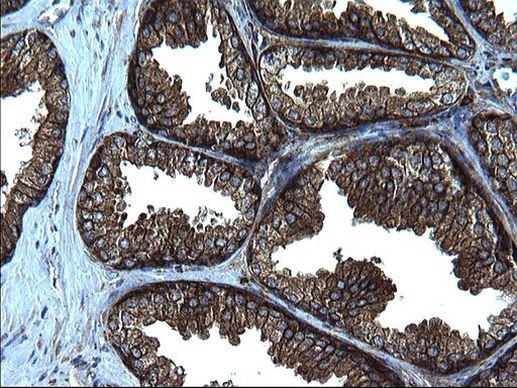 FNDC8 Antibody in Immunohistochemistry (Paraffin) (IHC (P))