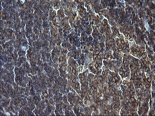 FNDC8 Antibody in Immunohistochemistry (Paraffin) (IHC (P))