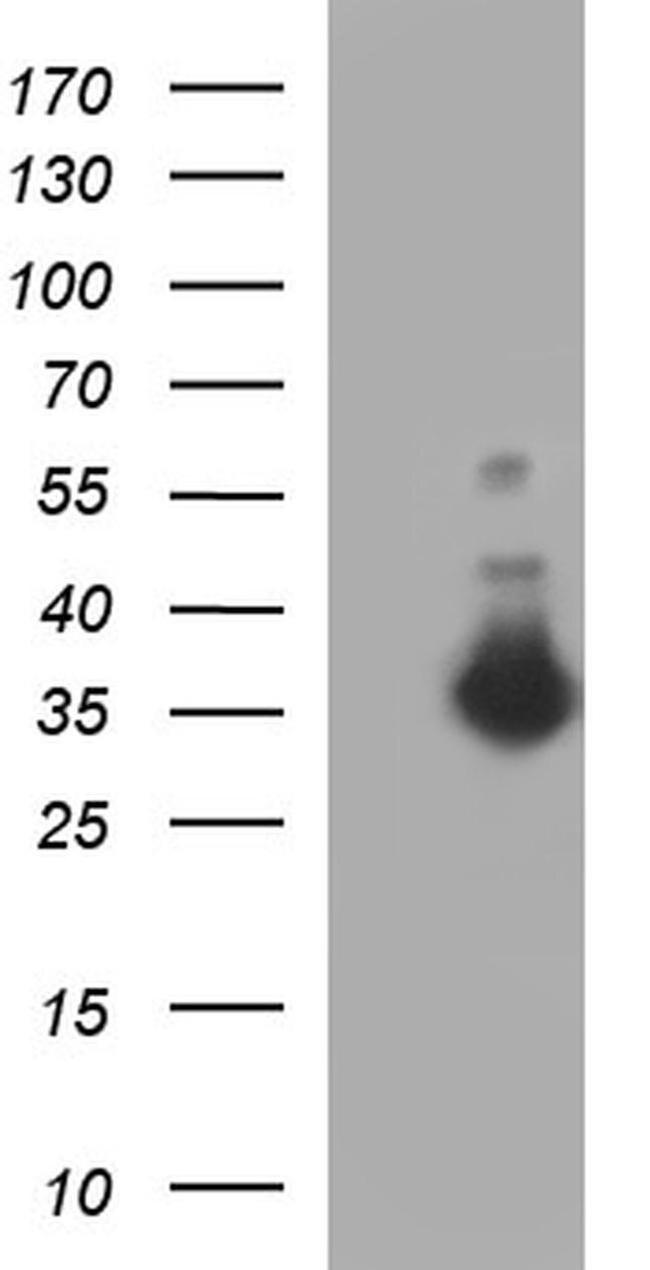 FNDC8 Antibody in Western Blot (WB)