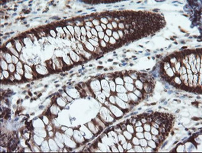 PYCARD Antibody in Immunohistochemistry (Paraffin) (IHC (P))