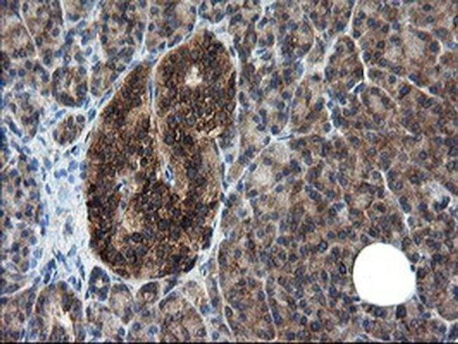 CNOT4 Antibody in Immunohistochemistry (Paraffin) (IHC (P))