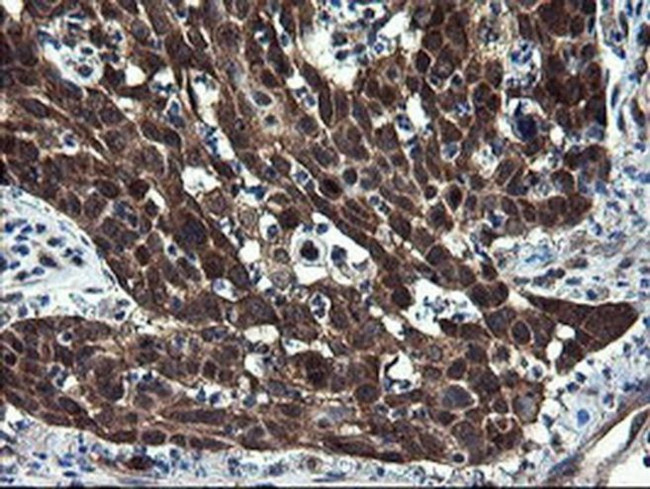 CNOT4 Antibody in Immunohistochemistry (Paraffin) (IHC (P))