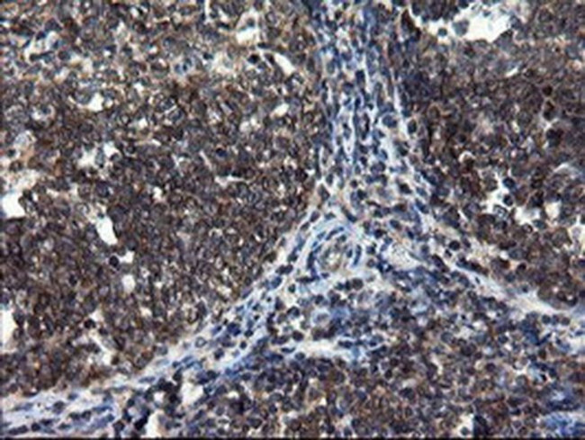 CNOT4 Antibody in Immunohistochemistry (Paraffin) (IHC (P))