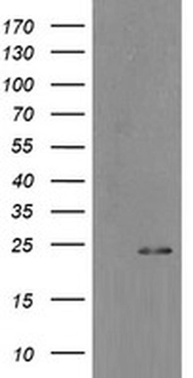 MYL7 Antibody in Western Blot (WB)