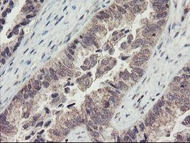 RBPMS Antibody in Immunohistochemistry (Paraffin) (IHC (P))