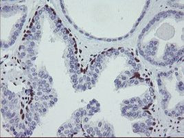 MEIS3 Antibody in Immunohistochemistry (Paraffin) (IHC (P))