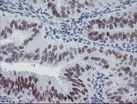 MEIS3 Antibody in Immunohistochemistry (Paraffin) (IHC (P))