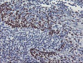 MEIS3 Antibody in Immunohistochemistry (Paraffin) (IHC (P))