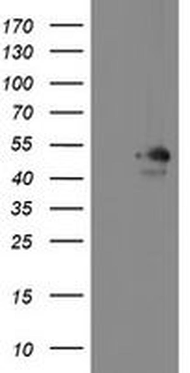 MEIS3 Antibody in Western Blot (WB)