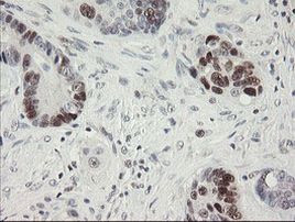 RFC2 Antibody in Immunohistochemistry (Paraffin) (IHC (P))