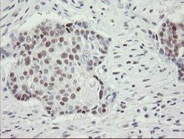 RFC2 Antibody in Immunohistochemistry (Paraffin) (IHC (P))