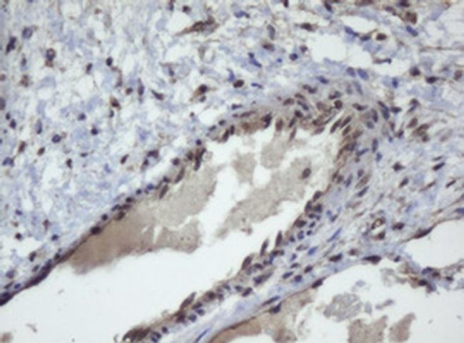 ZSCAN4 Antibody in Immunohistochemistry (Paraffin) (IHC (P))