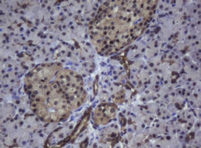 ZSCAN4 Antibody in Immunohistochemistry (Paraffin) (IHC (P))