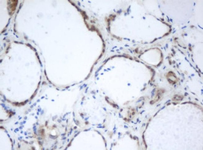 PRR11 Antibody in Immunohistochemistry (Paraffin) (IHC (P))