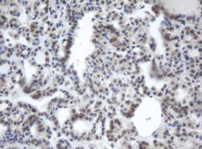 PRR11 Antibody in Immunohistochemistry (Paraffin) (IHC (P))