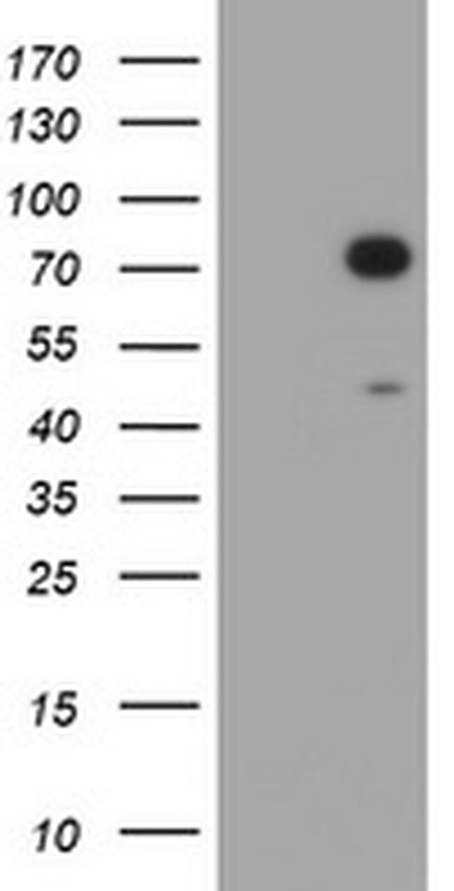 HIF3A Antibody in Western Blot (WB)