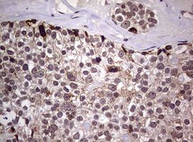 AFAP Antibody in Immunohistochemistry (Paraffin) (IHC (P))