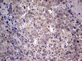 AFAP Antibody in Immunohistochemistry (Paraffin) (IHC (P))