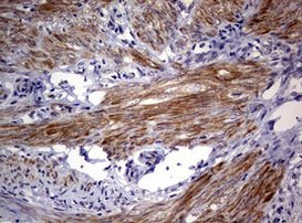 AFAP Antibody in Immunohistochemistry (Paraffin) (IHC (P))