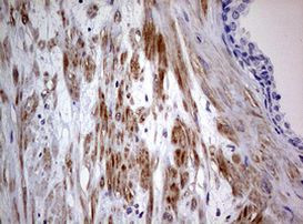 AFAP Antibody in Immunohistochemistry (Paraffin) (IHC (P))