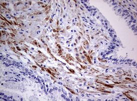 AFAP Antibody in Immunohistochemistry (Paraffin) (IHC (P))