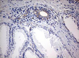 NDUFS2 Antibody in Immunohistochemistry (Paraffin) (IHC (P))