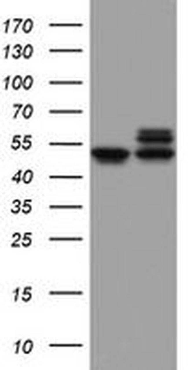 NDUFS2 Antibody in Western Blot (WB)