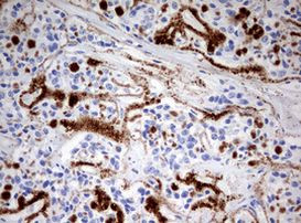 SPATA2L Antibody in Immunohistochemistry (Paraffin) (IHC (P))