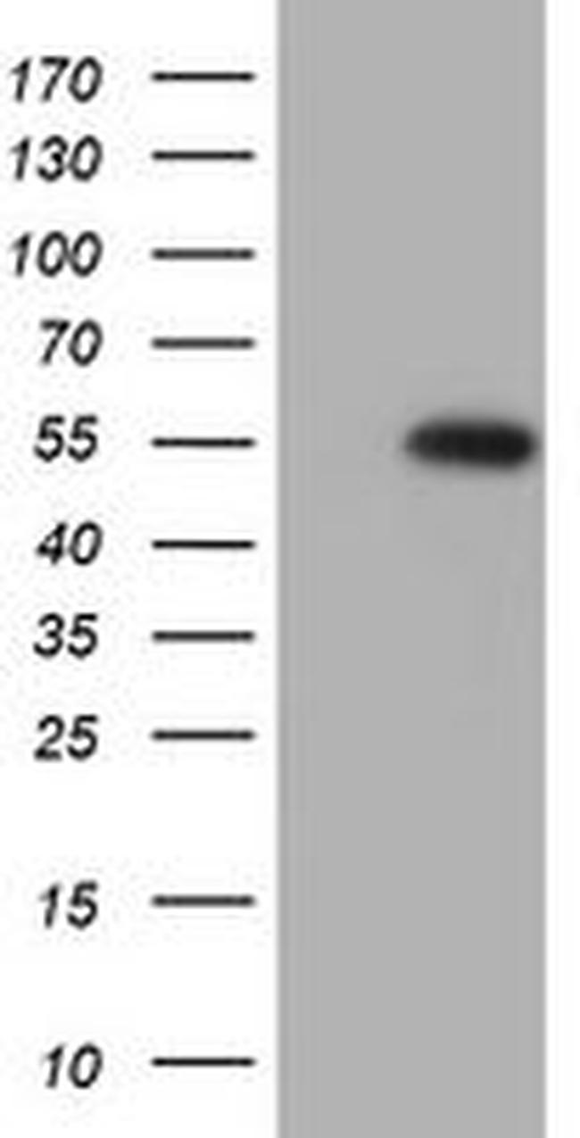 SPATA2L Antibody in Western Blot (WB)