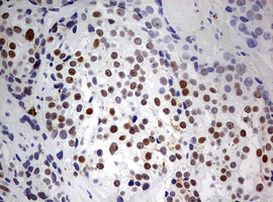 PARN Antibody in Immunohistochemistry (Paraffin) (IHC (P))