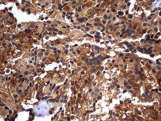 CK1 gamma-2 Antibody in Immunohistochemistry (Paraffin) (IHC (P))