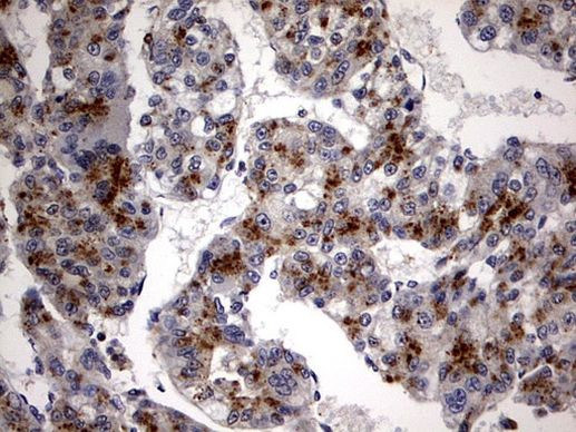 CK1 gamma-2 Antibody in Immunohistochemistry (Paraffin) (IHC (P))