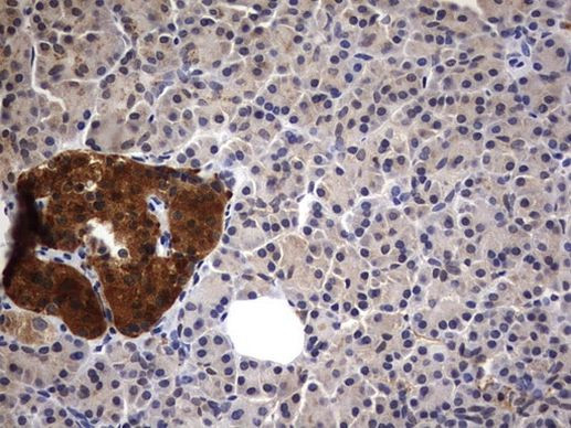 CK1 gamma-2 Antibody in Immunohistochemistry (Paraffin) (IHC (P))