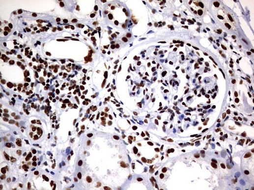 DDX56 Antibody in Immunohistochemistry (Paraffin) (IHC (P))