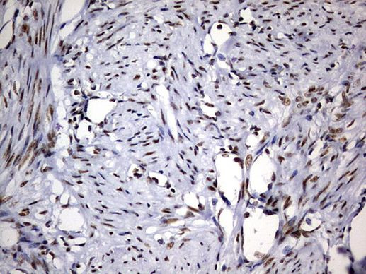 DDX56 Antibody in Immunohistochemistry (Paraffin) (IHC (P))