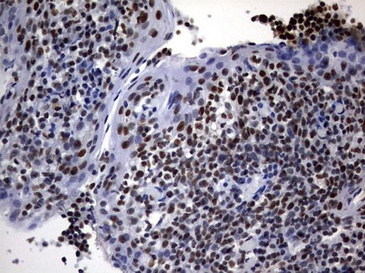 DDX56 Antibody in Immunohistochemistry (Paraffin) (IHC (P))