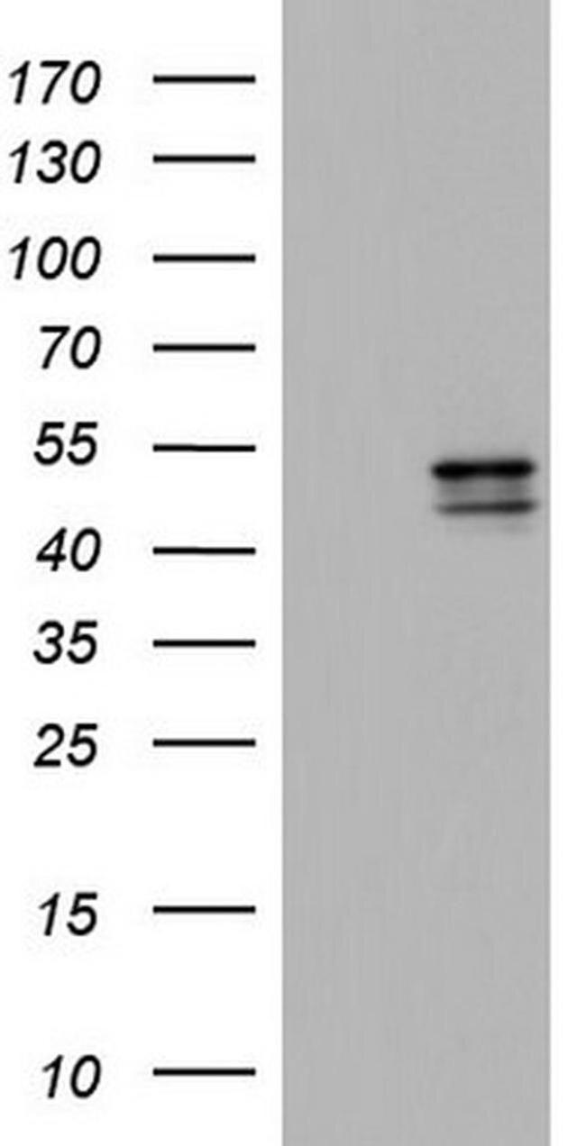 CK1 epsilon Antibody in Western Blot (WB)