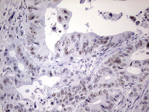 NAB2 Antibody in Immunohistochemistry (Paraffin) (IHC (P))