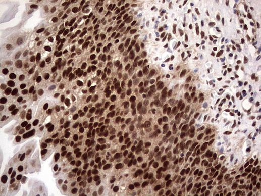 RTRAF Antibody in Immunohistochemistry (Paraffin) (IHC (P))