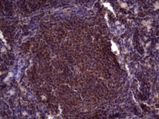 UFD1L Antibody in Immunohistochemistry (Paraffin) (IHC (P))